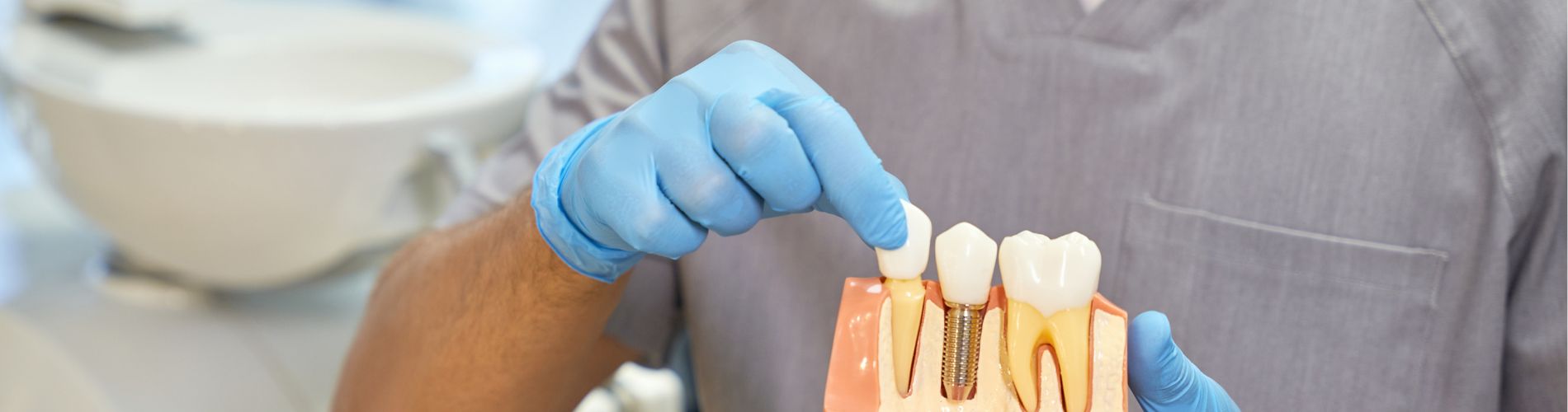 Dental Implants - Alvaro Ordonez